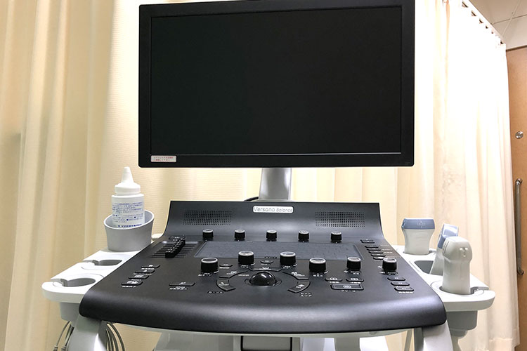 超音波診断装置